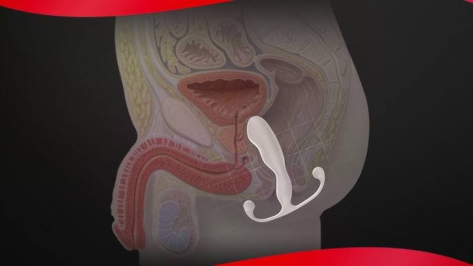 Masajeador de próstata